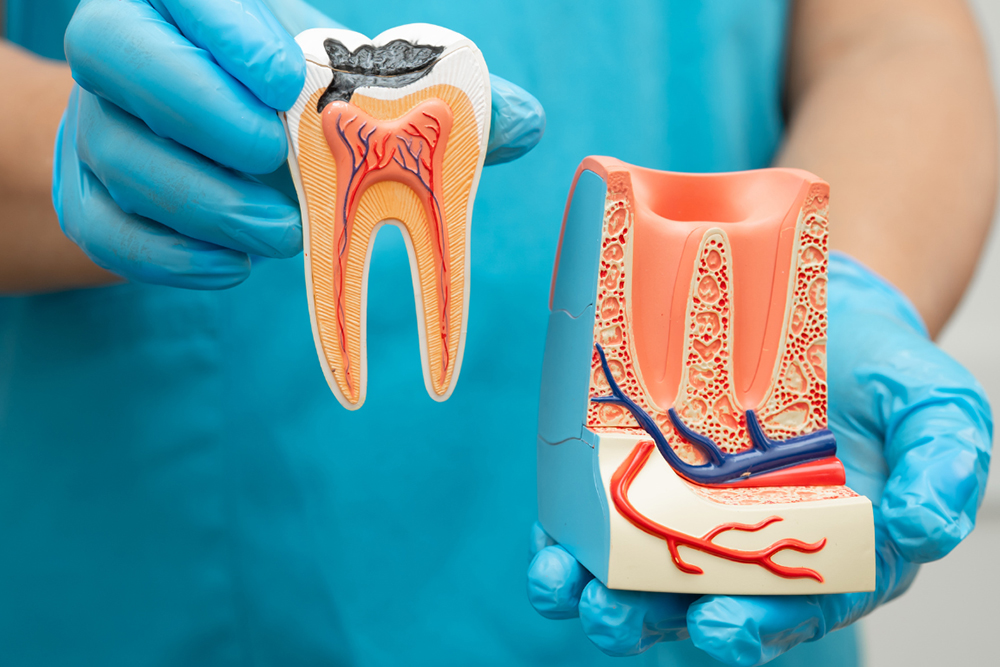 Dentist in Woodbridge performing pain-free root canal therapy at Napa Dental showing modern endodontic treatment